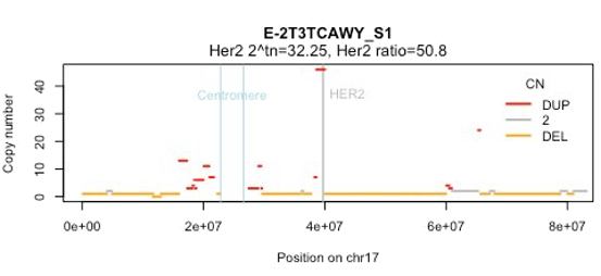 Example HER2 amplification