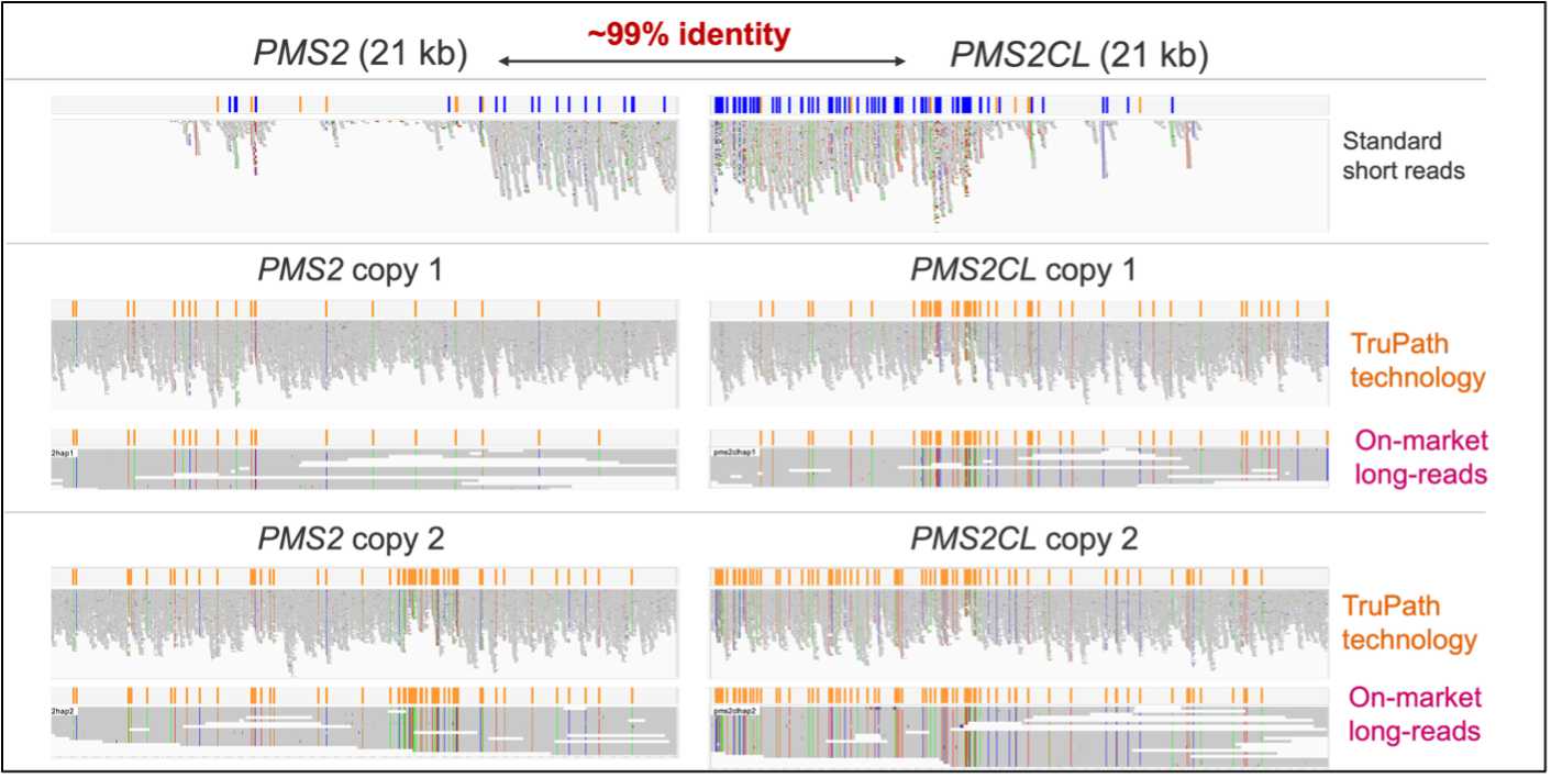 TruPath PMS2 haplotype visualization
